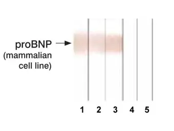 Anti-proBNP antibody [15F11] used in Western Blot (WB). GTX13115